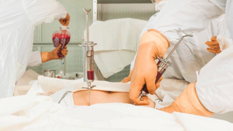 Hidden Costs of Bone Marrow Transplant: Insights from the Indian Healthcare System
